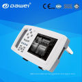 Scanner de ultrassom portátil DW-600 e ecografo